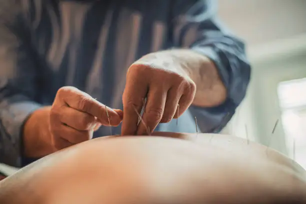 ims-intramuscular-stimulation-abbotsford.jpg
