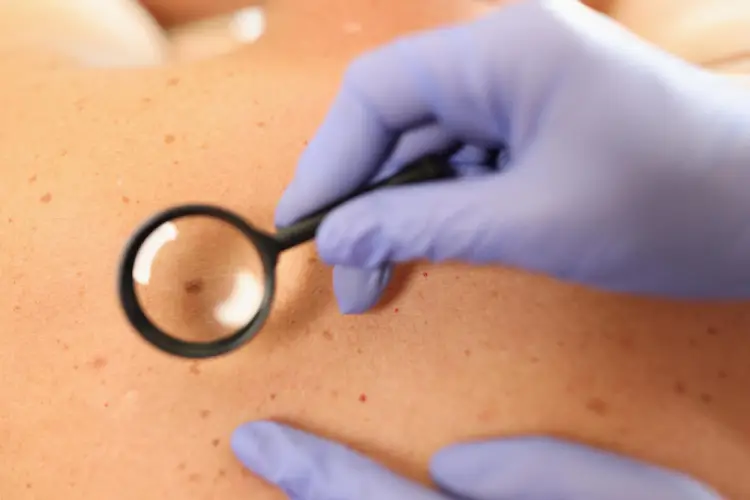 skin-examination-with-magnifier.jpg