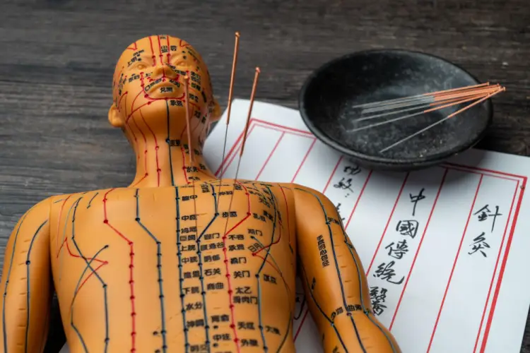 acupuncture-meridian-model-with-needles.jpg