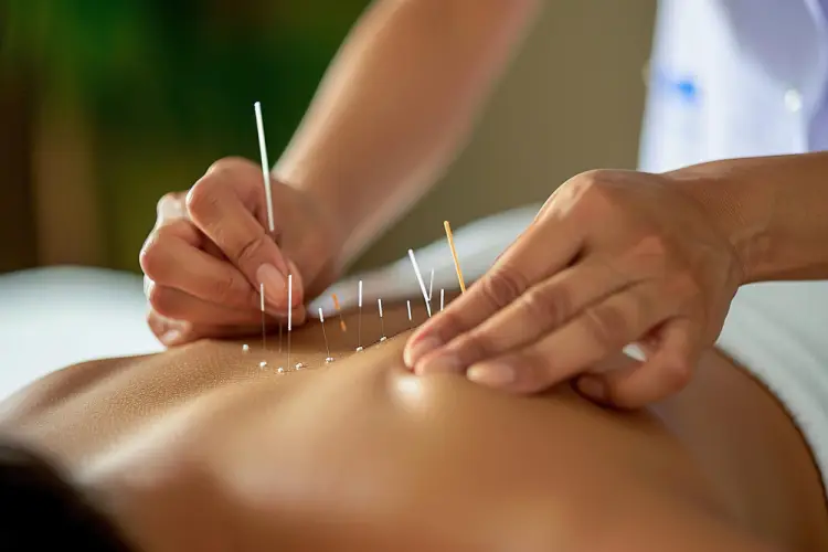 hands-performing-acupuncture-on-back.jpg
