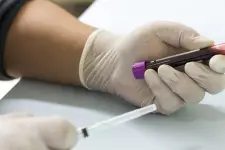 Alberta Precision Laboratories - 178 St NW - Edmonton business