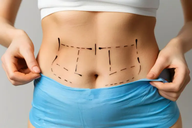 body-sculpting-marked-abdomen.jpg