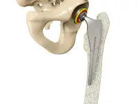 Advanced Orthopedic Systems Inc. - Edmonton business