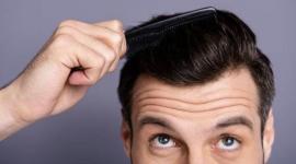Revitalize Your Look: Men's Hair Solutions in Calgary - Haircuts & Coloring listing in Calgary