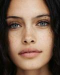 Advanced Intense Pulsed Light (IPL) Treatment Toronto - Toronto - Specialist Consultations listing