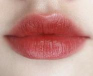 Non-Surgical Lip Enhancement Toronto Treatment - Toronto - Specialist Consultations listing