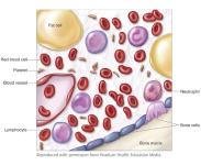 What are Blood & bone marrow cancers - Lymphoma & Leukemia - Toronto - Specialist Consultations listing