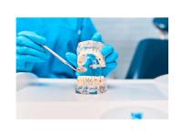 Get Strong, Natural-Looking Crowns & Bridges in Brampton - Toronto - Specialist Consultations listing