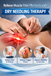 IMS Physiotherapy in Abbotsford | Dry Needling therapy - Abbotsford - Therapy Sessions listing