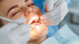 Looking for the Best Dental Clinic in Mississauga Same-Day  Emergency - Toronto - Eyelash Extensions listing