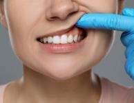 Multiple Teeth Replacement Vancouver | Implant Bridges - Specialist Consultations listing in Vancouver
