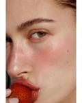 Rosacea Laser Treatment Toronto | Tight Clinic | Book Today - Specialist Consultations listing in Toronto