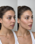 Aesthetic Clinic in Toronto for Personalized Skin Care - Special Effects Makeup listing in Toronto